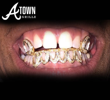 ATown Diamond MIX UPS (Mixed Diamonds)