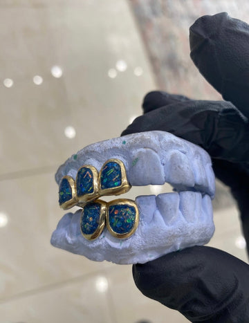 Atown Grillz "BLUE OPAL MAGIC" Grillz