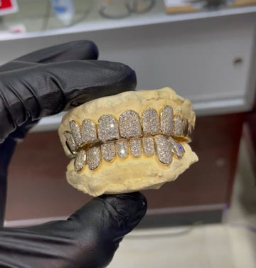 ATOWN BIG BALLER MOSSINATE GRILLZ