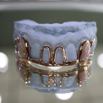 Atown Grillz Rose Gold "PINK CREAM OPAL"