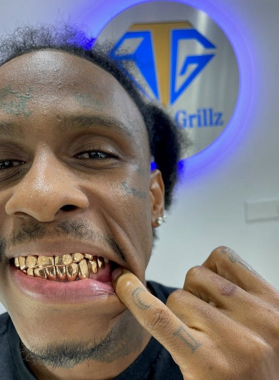 Custom Grillz 22K