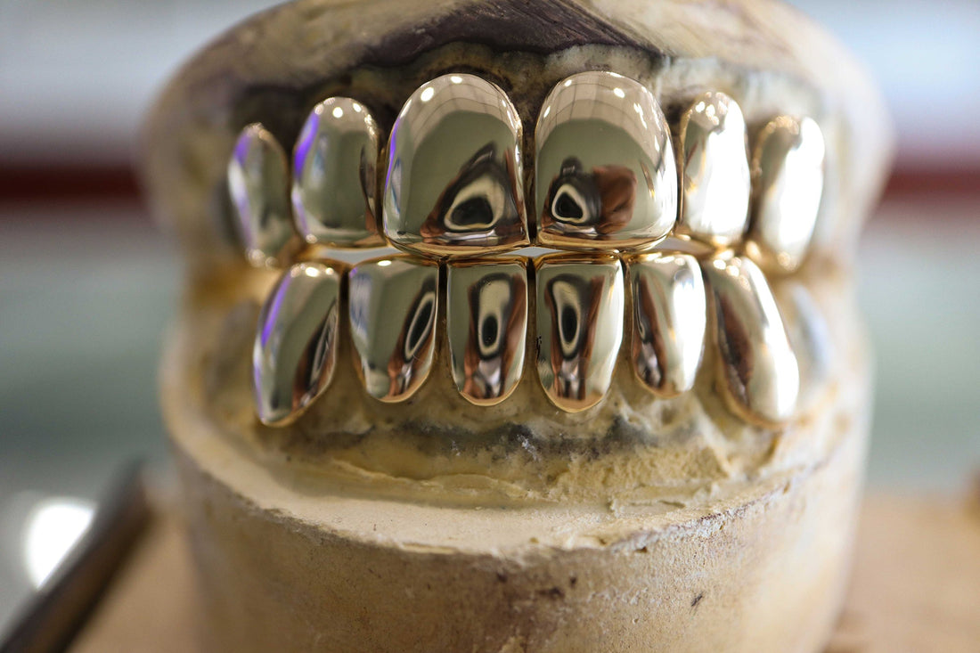 Custom Grillz 14K