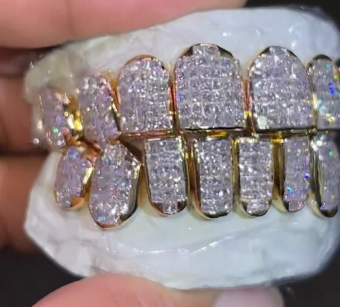 INVISIBLE SET NATURAL DIAMOND VS GRILLZ