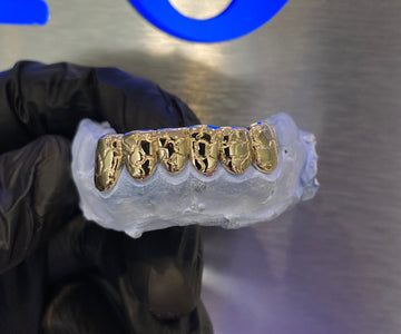 Atown Grillz "CRAZY NUGGET" Custom Grillz