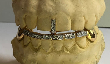 DIAMOND GAP FILLER With 8 Pcs Diamond Bar