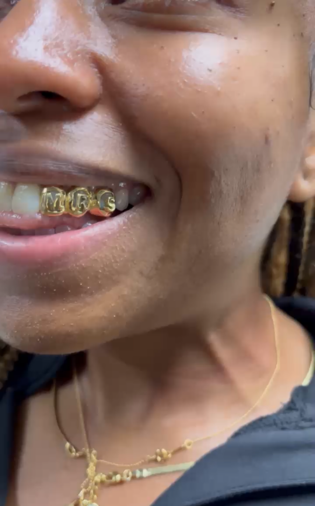 ATown MRS Grillz