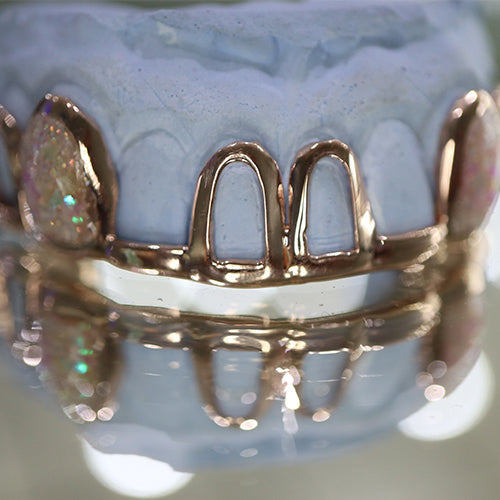 Atown Grillz Rose Gold "PINK CREAM OPAL"