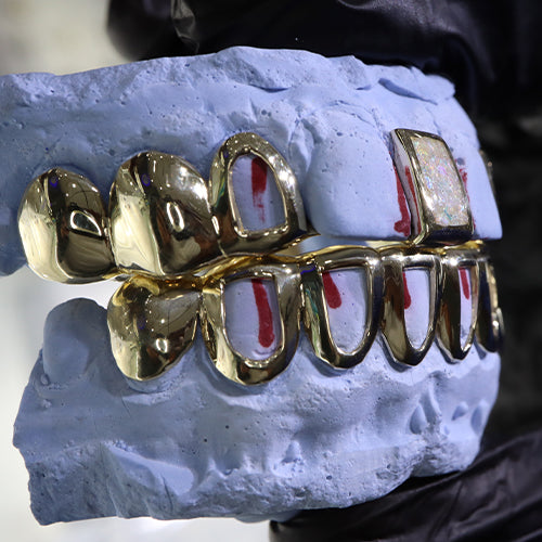 Atown Grillz "PEARL OF OPAL WITH GAP"